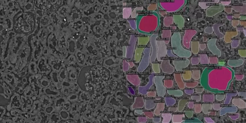 Microscopy image overlaid with segmentation.